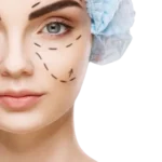 Best Blepharoplasty Surgery in India