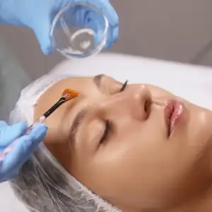 Chemical Peel Treatment in Delhi