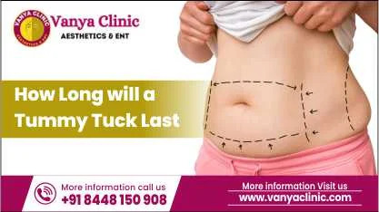 How log will tummy tuck last