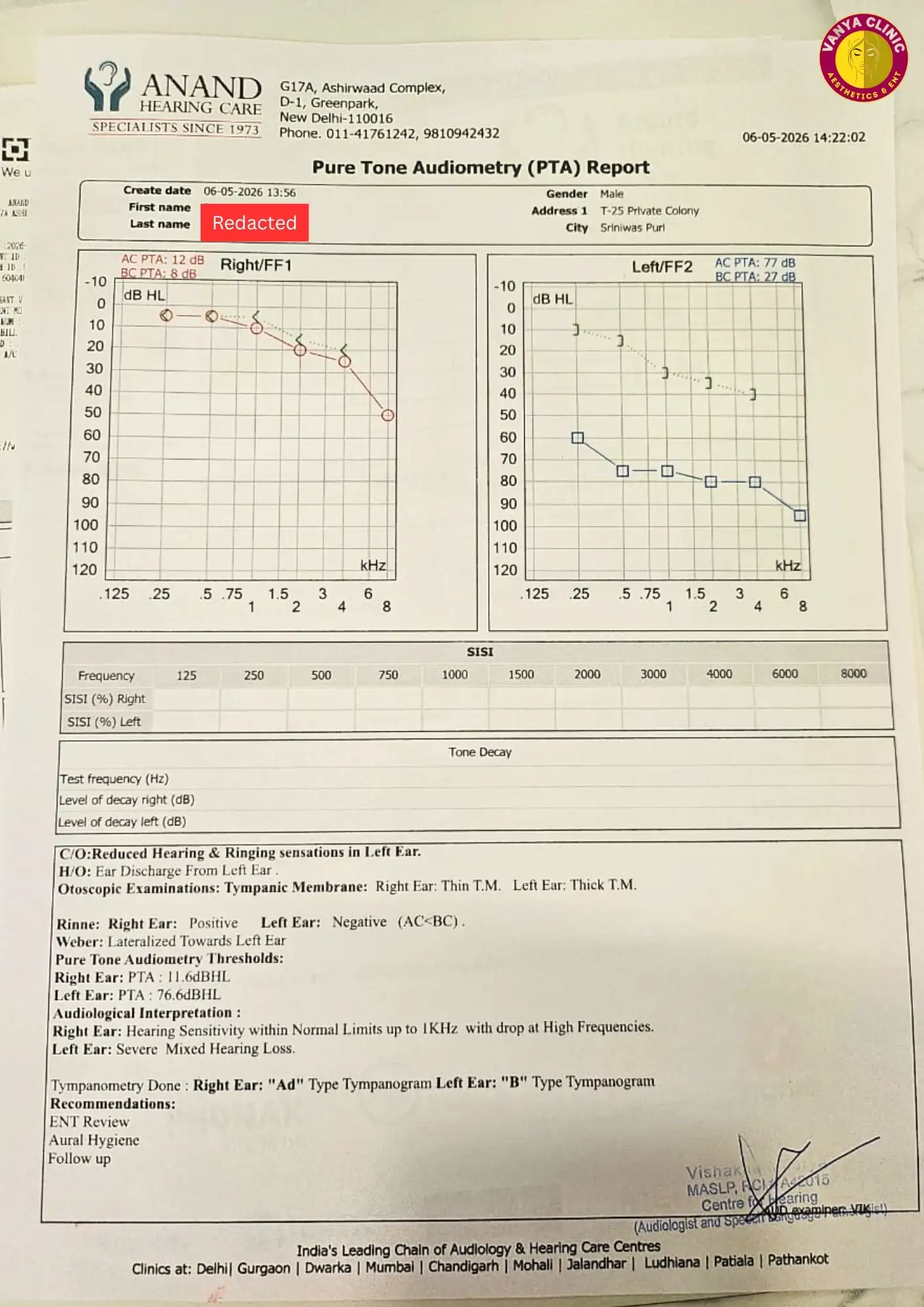 Stapedotomy Otosclerosis Surgery in Delhi - Get 10% Off Cost 3 Pure Tone Audiometry report of Male Patient from Sriniwaspuri in South Delhi - 6-5-2026