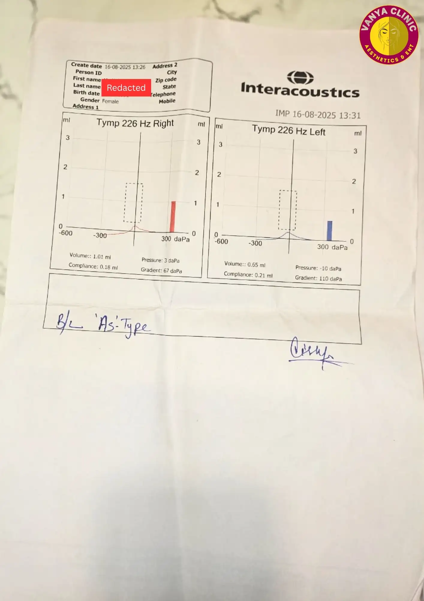 Stapedotomy Otosclerosis Surgery in Delhi - Get 10% Off Cost 5 Tympanometry report for hearing loss test of Delhi Patient - 16-8-2025
