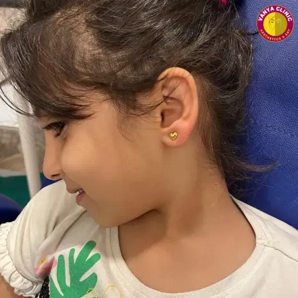 Child Lobe Piercing in Delhi by Dr. Purodha Prasad Child Lobe Piercing in Delhi by Dr. Purodha Prasad