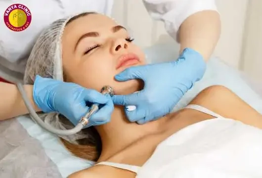 Dermabrasion Technique for Scar Removal Surgery in South Delhi