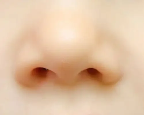 Flat Nose or Wide nose