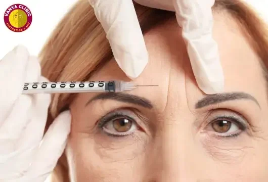 Frown Line or Glabella Lines Botox treatment in South Delhi near Green Park