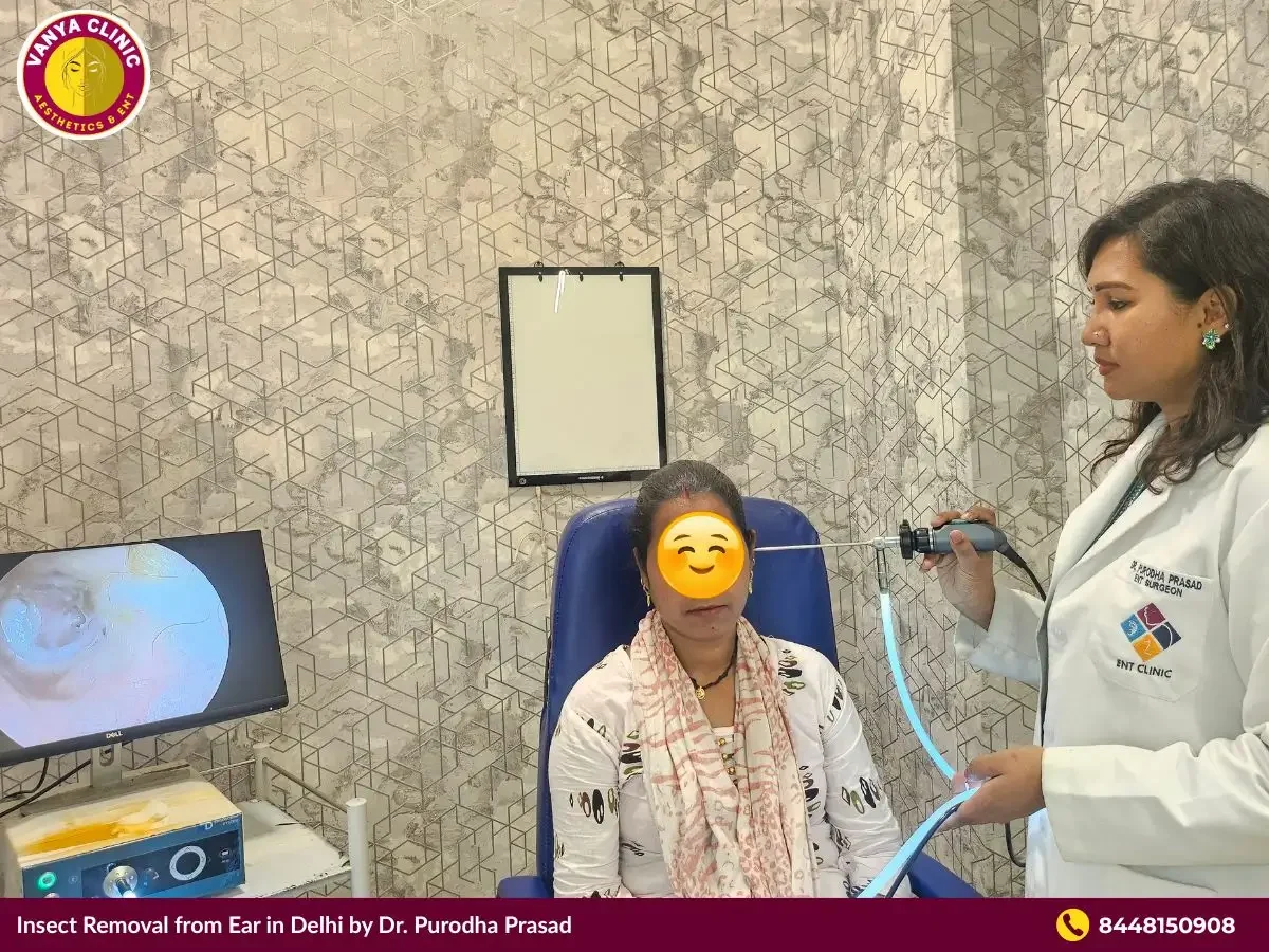 Dr. Purodha Prasad doing endoscopic removal of foreign body from Ear in Delhi.
