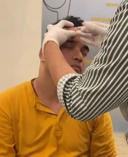 Male Client Availing Botox Near Green Park, New Delhi