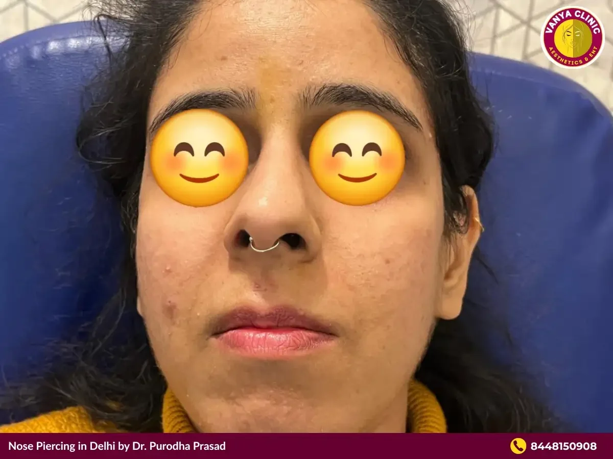 Patient with Nose Piercing done by Dr. Purodha Prasad.