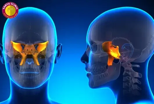 Sphenoid Sinus Treatment in Delhi with Balloon Sinuplasty