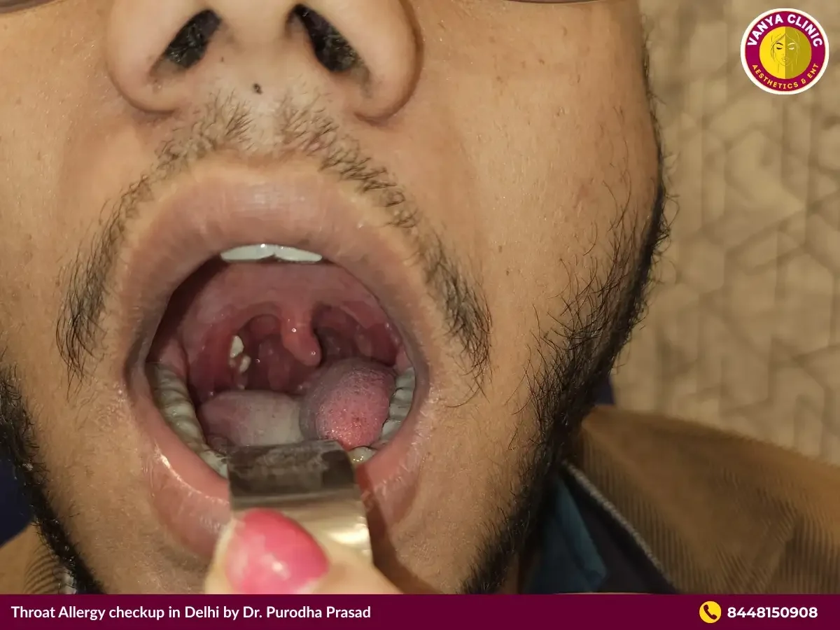 Throat inspection for allergy checkup.