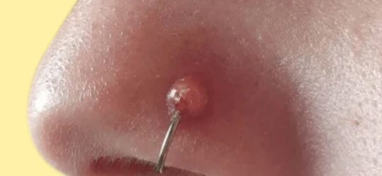 Nose Piercing in Delhi